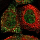 Immunofluorescent staining of human cell line A-431 shows localization to nucleoplasm & vesicles.