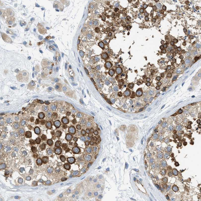 Anti-KLHDC10 Antibody