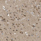 Immunohistochemical staining of human cerebral cortex shows strong cytoplasmic positivity in neuronal cells.