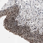 Anti-C7orf25 Antibody