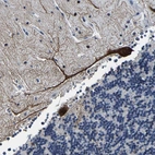 Anti-UBN2 Antibody