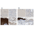 Anti-SERPINB5 Antibody