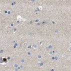 Anti-SERPINB5 Antibody