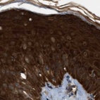 Immunohistochemical staining of human skin using Anti-SERPINB5 antibody HPA020136.