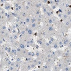 Immunohistochemical staining of human liver using Anti-SERPINB5 antibody HPA020136.
