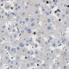 Anti-SERPINB5 Antibody