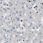 Immunohistochemical staining of human liver using Anti-SERPINB5 antibody HPA020136.
