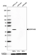 Western blot analysis in HeLa cells transfected with control siRNA, target specific siRNA probe #1 and #2, using Anti-SERPINB5 antibody. Remaining relative intensity is presented. Loading control: Anti-PPIB.