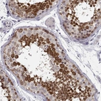 Immunohistochemical staining of human testis shows high expression.