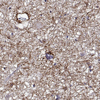 Immunohistochemical staining of human hypothalamus shows strong cytoplasmic positivity in subsets of glial cells and in processes.