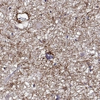 Immunohistochemical staining of human hypothalamus shows strong cytoplasmic positivity in subsets of glial cells and in processes.