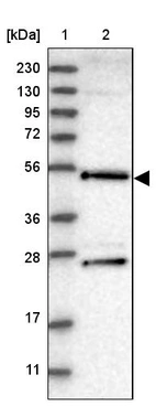 Lane 1: Marker [kDa] 230, 130, 95, 72, 56, 36, 28, 17, 11_br/_Lane 2: Human cell line RT-4