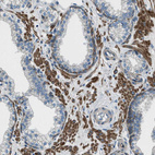 Immunohistochemical staining of human prostate shows strong cytoplasmic positivity in smooth muscle cells.