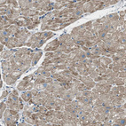 Immunohistochemical staining of human heart muscle shows moderate cytoplasmic positivity in cardiomyocytes.