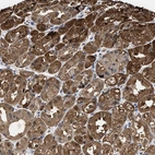 Anti-KIF12 Antibody