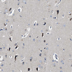 Immunohistochemical staining of human cerebral cortex shows moderate cytoplasmic positivity in neurons.
