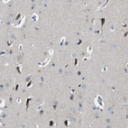 Immunohistochemical staining of human cerebral cortex shows moderate cytoplasmic positivity in neurons.