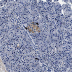 Anti-CACNA1D Antibody