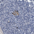 Immunohistochemical staining of human pancreas shows moderate cytoplasmic positivity in islets of Langerhans.