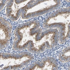 Anti-PPP1R15A Antibody