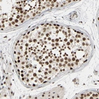 Immunohistochemical staining of human testis shows moderate nuclear positivity in cells in seminiferous ducts.