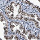 Immunohistochemical staining of human fallopian tube shows moderate nuclear positivity in glandular cells.