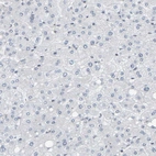 Immunohistochemical staining of human liver shows no positivity in hepatocytes.