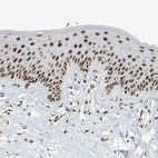 Immunohistochemical staining of human skin shows moderate nuclear positivity in squamous epithelial cells.