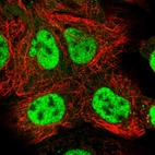 Immunofluorescent staining of human cell line A-431 shows localization to nucleoplasm.