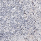Immunohistochemical staining of human tonsil shows low expression as expected.