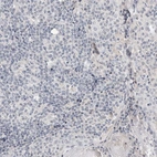Immunohistochemical staining of human tonsil shows low expression as expected.