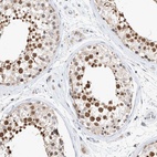 Immunohistochemical staining of human testis shows high expression.