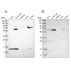Western blot analysis using Anti-CRAT antibody HPA020260 (A) shows similar pattern to independent antibody HPA019230 (B).