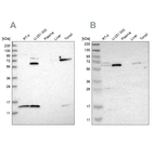 Western blot analysis using Anti-CRAT antibody HPA020260 (A) shows similar pattern to independent antibody HPA019230 (B).