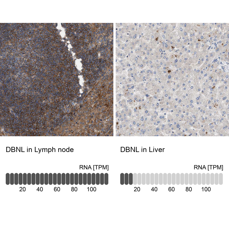 Anti-DBNL Antibody