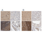Immunohistochemical staining of human cerebral cortex, liver, lymph node and testis using Anti-DBNL antibody HPA020265 (A) shows similar protein distribution across tissues to independent antibody HPA027735 (B).