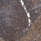 Immunohistochemical staining of human lymph node shows high expression.
