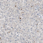 Immunohistochemical staining of human liver shows low expression as expected.