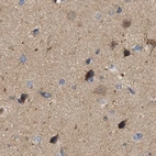 Immunohistochemical staining of human cerebral cortex using Anti-DBNL antibody HPA020265.