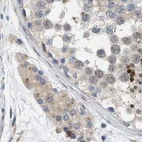 Immunohistochemical staining of human testis using Anti-DBNL antibody HPA020265.