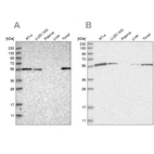 Western blot analysis using Anti-DBNL antibody HPA020265 (A) shows similar pattern to independent antibody HPA027735 (B).