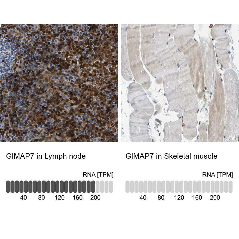 Anti-GIMAP7 Antibody