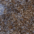 Immunohistochemical staining of human lymph node shows high expression.