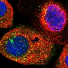 Immunofluorescent staining of human cell line A-431 shows localization to vesicles.