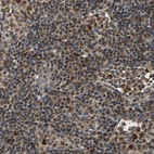 Immunohistochemical staining of human lymph node shows strong cytoplasmic positivity in non-germinal center cells.