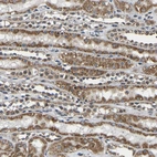 Immunohistochemical staining of human kidney shows strong cytoplasmic granular positivity in cells in tubules.