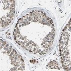 Immunohistochemical staining of human testis shows strong cytoplasmic positivity in cells in seminiferous ducts and Leydig cells.
