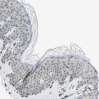 Immunohistochemical staining of human skin shows negative to very weak positivity in squamous epithelial cells.