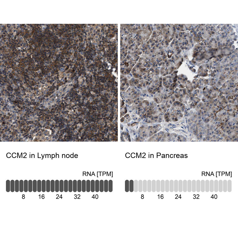 Anti-CCM2 Antibody