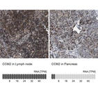 Anti-CCM2 Antibody